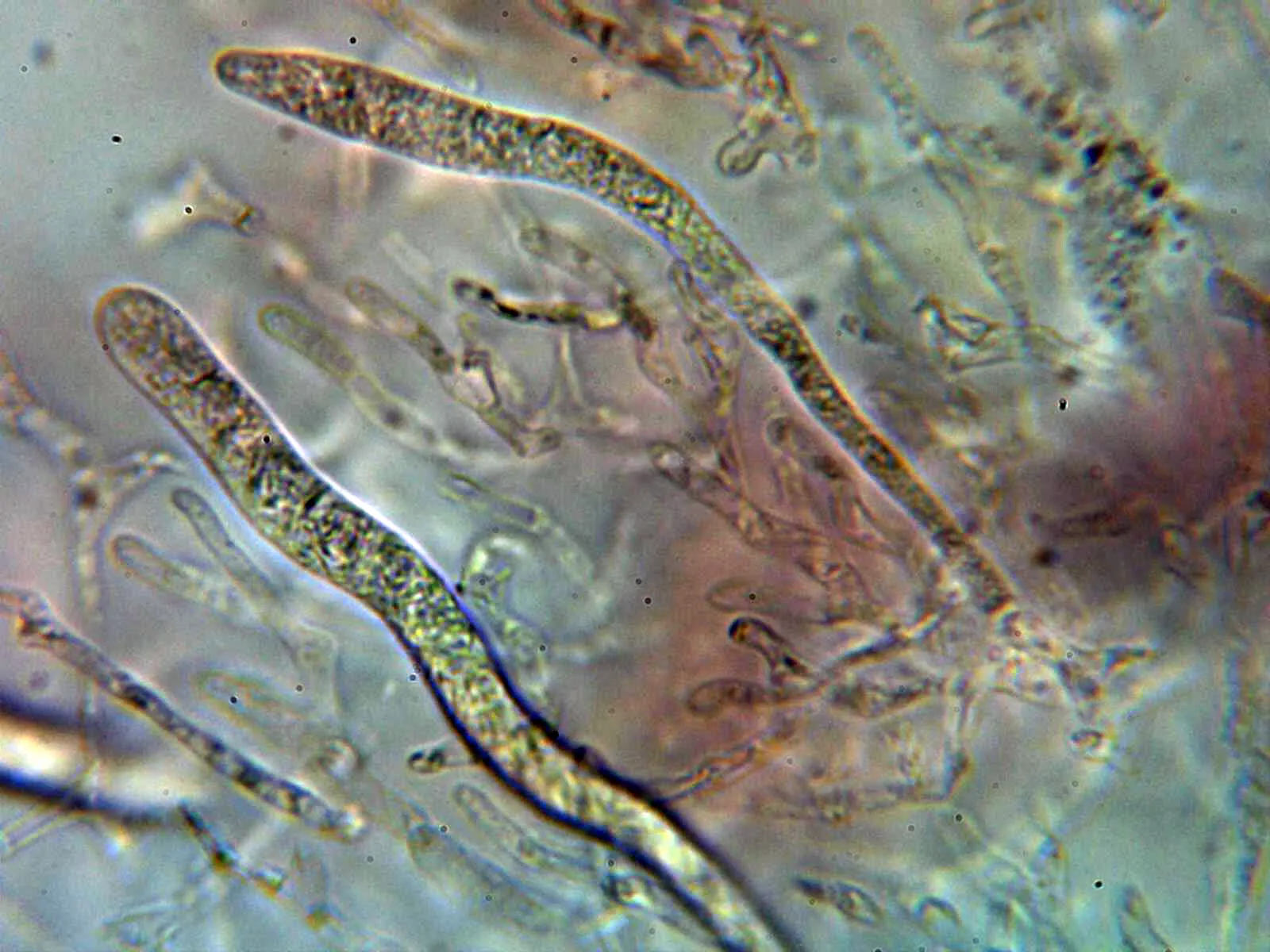 Microscopía de Russula nauseosa - 11 - Pileocistidios 2